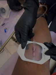 Luxe Concierge IV Hydration & Botox image 8