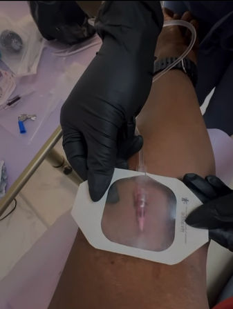 Luxe Concierge IV Hydration & Botox image 7