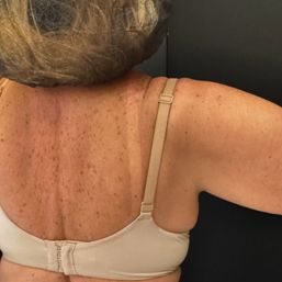 Mobile Spray Tan Experience with Morena Miami Tan image 9