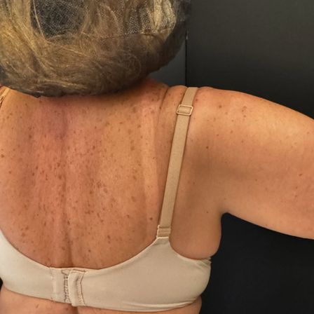 Mobile Spray Tan Experience with Morena Miami Tan image 9