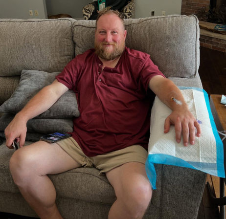 Bearded man in a maroon shirt and khaki shorts smiling on a gray living-room couch with an IV catheter taped to his right arm resting on a disposable pad, smartphone on his lap — casual home recovery scene.