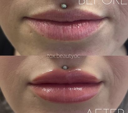 Tox Aesthetics