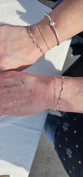 Sunlit close-up of two wrists wearing stacked silver-tone bracelets and delicate chain bracelets, minimalist jewelry detail.