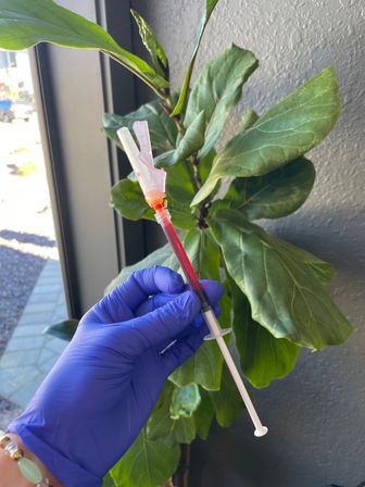Hand in a purple glove holding a syringe-style IV catheter filled with red liquid, photographed indoors by a window with a bright green fiddle-leaf fig plant in the background.