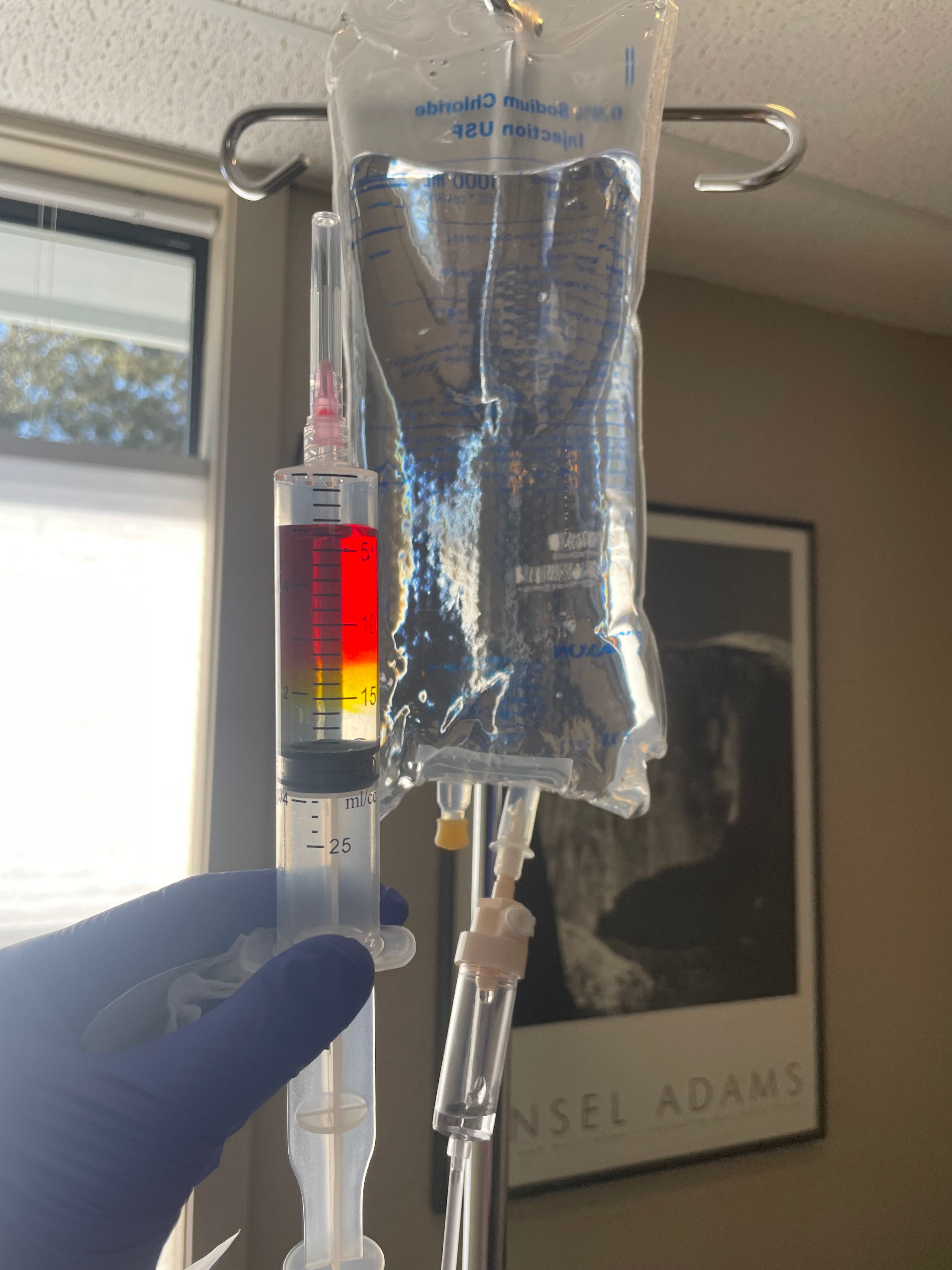 Gloved hand holding a syringe filled with red-to-yellow medication beside a clear IV saline bag hanging from a pole in a sunlit patient room, window and framed black-and-white landscape print in the background.