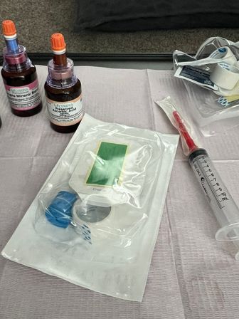 Clinic treatment tray on a disposable drape with sealed sterile dressing and tubing, two amber reagent bottles with orange caps, and a 10 mL syringe ready for use.