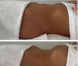 Two-panel before-and-after spa-style photo of a tanned torso midsection wrapped in white towels, top panel showing a flatter abdomen and bottom panel showing more defined contours with hands adjusting the towel.