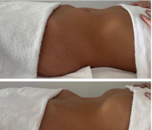 Two-panel before-and-after spa-style photo of a tanned torso midsection wrapped in white towels, top panel showing a flatter abdomen and bottom panel showing more defined contours with hands adjusting the towel.