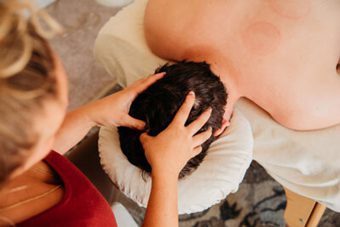 Spa-style overhead shot of a client face-down in a massage face cradle receiving a relaxing scalp and head massage, with circular cupping marks visible on the upper back.