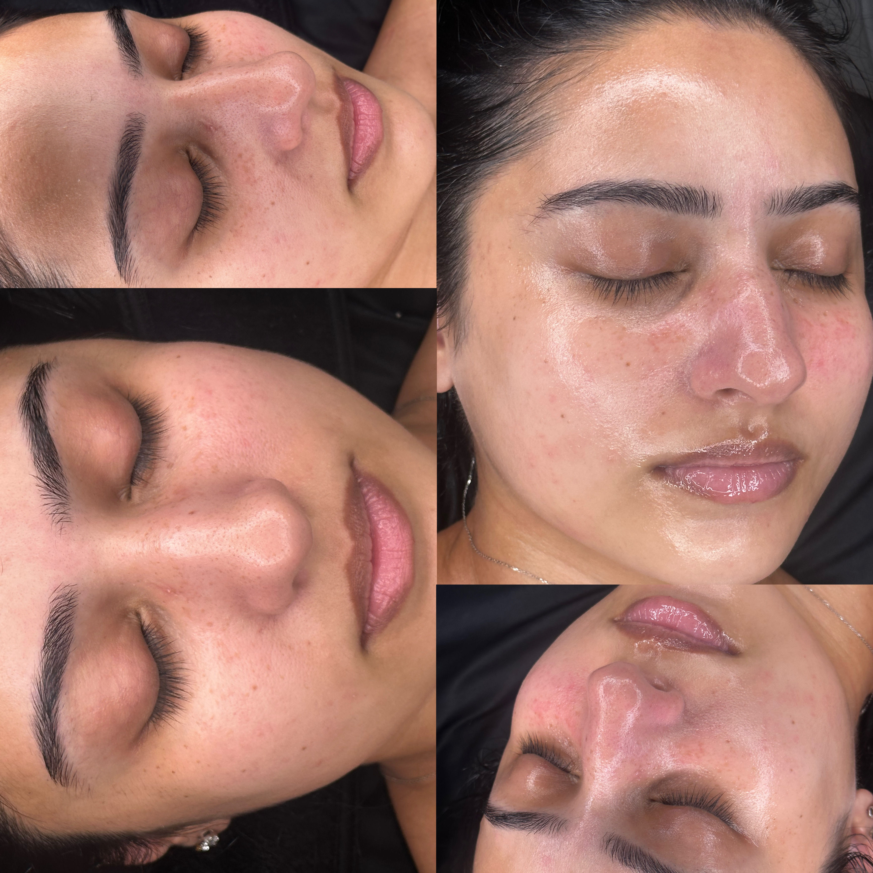 Glowy facial collage: close-up shots of a person's face during a skincare treatment showing dewy, hydrated skin, visible pores and freckles, groomed brows and natural lashes.