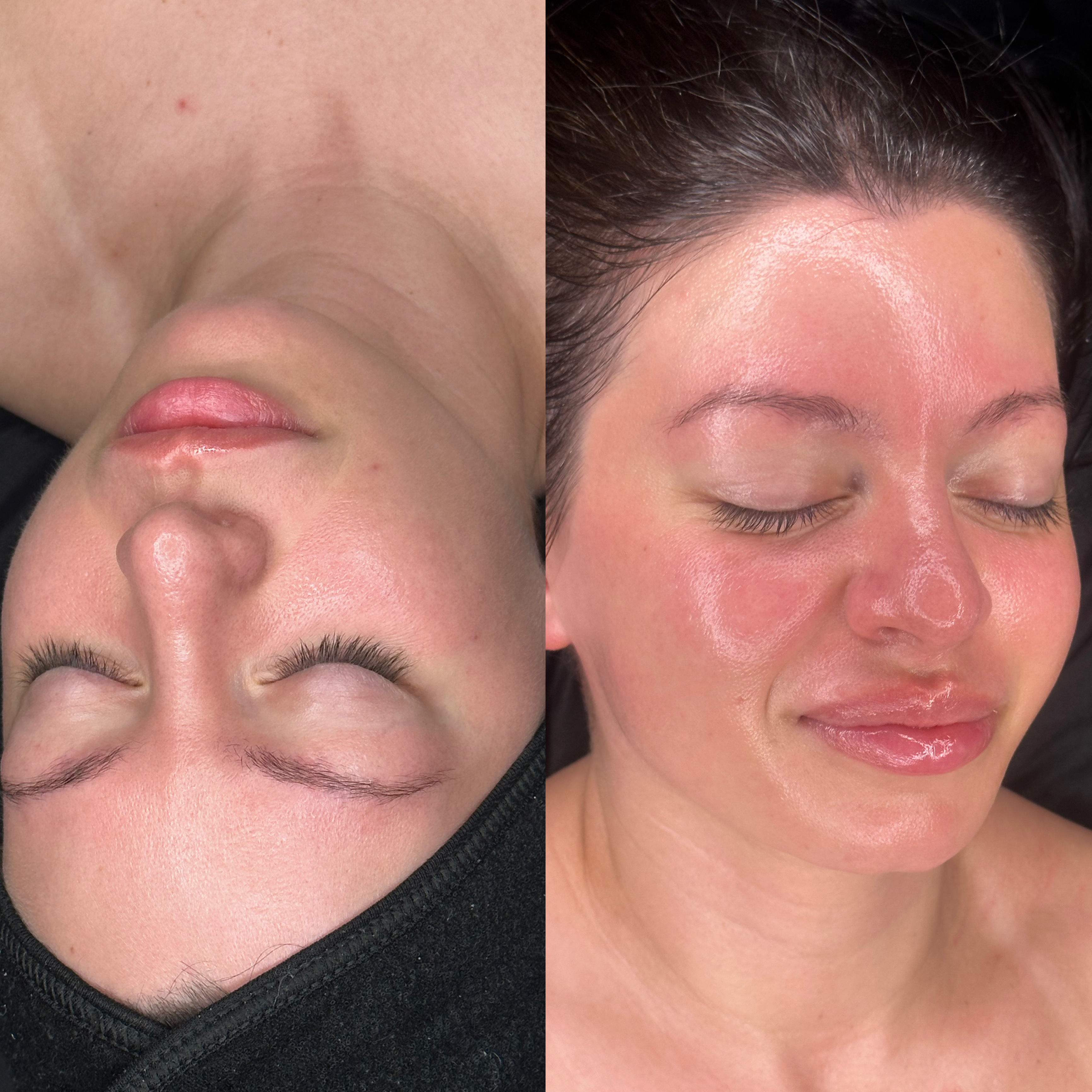 Split close-up of a person's face showing a spa facial glow-up: left pre-treatment with calm skin, right post-treatment with red, glossy, glowing skin and closed eyes.