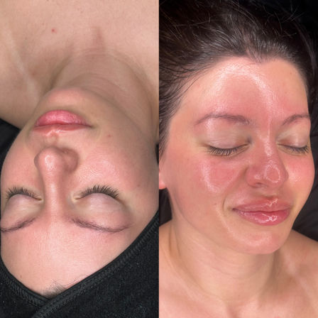 Split close-up of a person's face showing a spa facial glow-up: left pre-treatment with calm skin, right post-treatment with red, glossy, glowing skin and closed eyes.