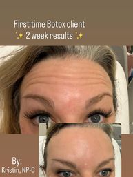 Botox and Beauty Bash Charleston image 7