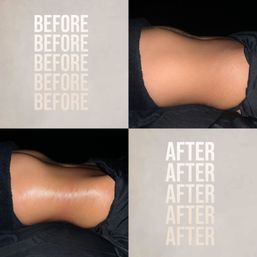 Before-and-after collage showing side view of a tanned abdomen — smoother, sleeker waist and glossy skin after a body treatment, photographed on dark linens.
