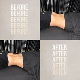 Austin Bachelorette Detox & Body Sculpting Experience at The Tox image 4