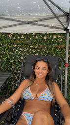 Smiling woman in a blue floral bikini reclining on a black lounge chair under a canopy, sunglasses on her head with a leafy privacy wall behind her and an IV tube taped to her arm—relaxed poolside vibe.