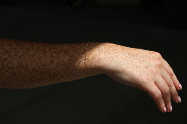 Sunlit freckled forearm and hand wearing a delicate gold chain bracelet, close-up against a dark background.