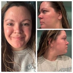 Three-panel collage of close-up selfies showing a smiling woman with wet hair and a nose ring, front and two profile views highlighting rosy skin and a casual gray sweatshirt in an indoor bathroom setting.