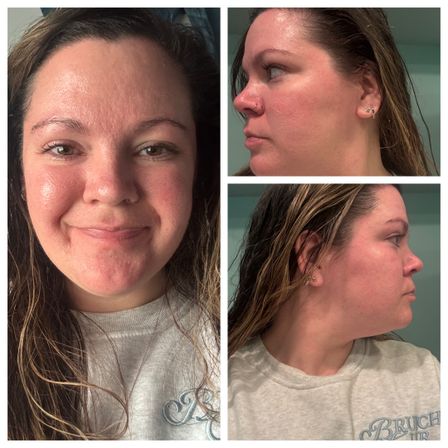 Three-panel collage of close-up selfies showing a smiling woman with wet hair and a nose ring, front and two profile views highlighting rosy skin and a casual gray sweatshirt in an indoor bathroom setting.