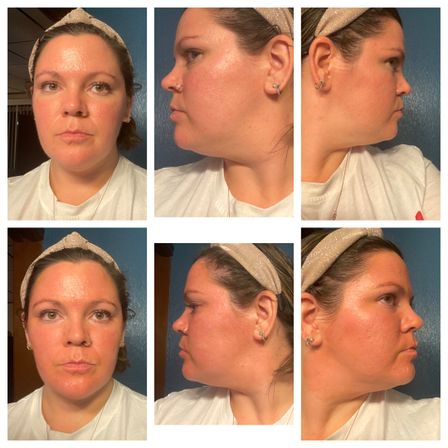 Six-photo indoor portrait collage showing close-up front and side views of a woman wearing a sparkly headband and nose ring, white shirt, and earrings against a blue wall — clear facial features and skin texture.