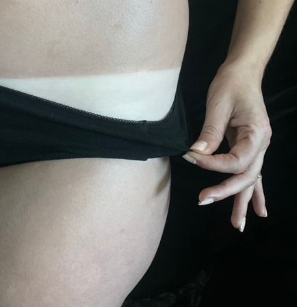 Close-up of a hip with a hand pulling black underwear to reveal a pale sun tan line across the waist.
