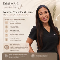 Smiling clinician in black scrubs in an aesthetic clinic next to a promotional poster for microneedling titled 'Reveal Your Best Skin' — benefits listed include stimulating collagen, improving texture, reducing acne scars, enhancing product absorption, and being safe for all skin types, with a call-to-action to book a consultation.