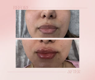 Botox , injectable filler  ,aesthetic treatment , and IV hydration wellness list image 7