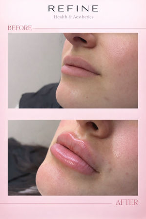 Botox , injectable filler  ,aesthetic treatment , and IV hydration wellness list image 8