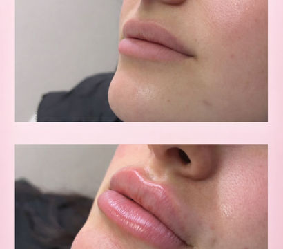 Refine Health and Aesthetics