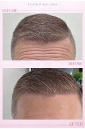 Botox , injectable filler  ,aesthetic treatment , and IV hydration wellness list image 5