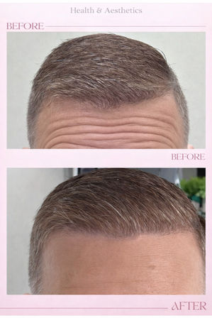 Botox , injectable filler  ,aesthetic treatment , and IV hydration wellness list image 5