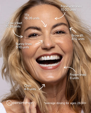 Close-up of a smiling woman with a cheerful aesthetic injectables infographic showing average neurotoxin dosing by area — forehead 10-20 units, 11’s 16-26, crow’s feet 12-28, bunny lines 5-10, brow lift 8-12, frown lines 8, chin 4-8 (average for ages 28-50+).