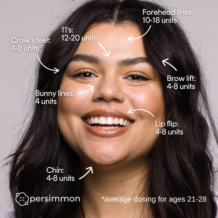 Smiling young woman's face annotated with cosmetic injection dosing guide for ages 21-28 — forehead 10-18 units, glabellar 11s 12-20, crow's feet 4-8, bunny lines 4, brow lift 4-8, lip flip 4-8, chin 4-8.